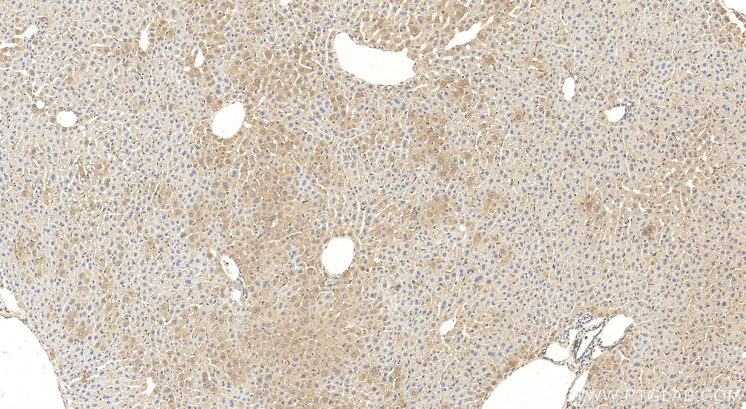 Immunohistochemistry (IHC) staining of mouse liver tissue using MTHFD1 Polyclonal antibody (10794-1-AP)