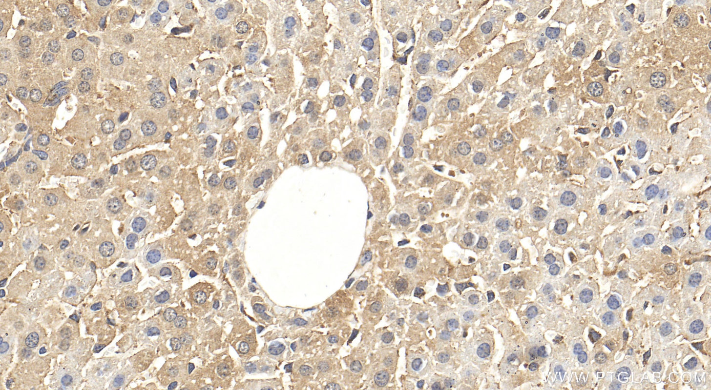 Immunohistochemistry (IHC) staining of mouse liver tissue using MTHFD1 Polyclonal antibody (10794-1-AP)
