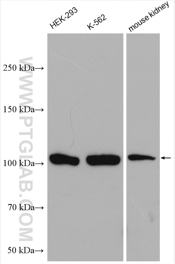 Western Blot (WB) analysis of various lysates using MTHFD1 Polyclonal antibody (10794-1-AP)