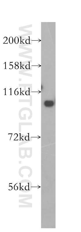 Western Blot (WB) analysis of human brain tissue using MTHFD1 Polyclonal antibody (10794-1-AP)