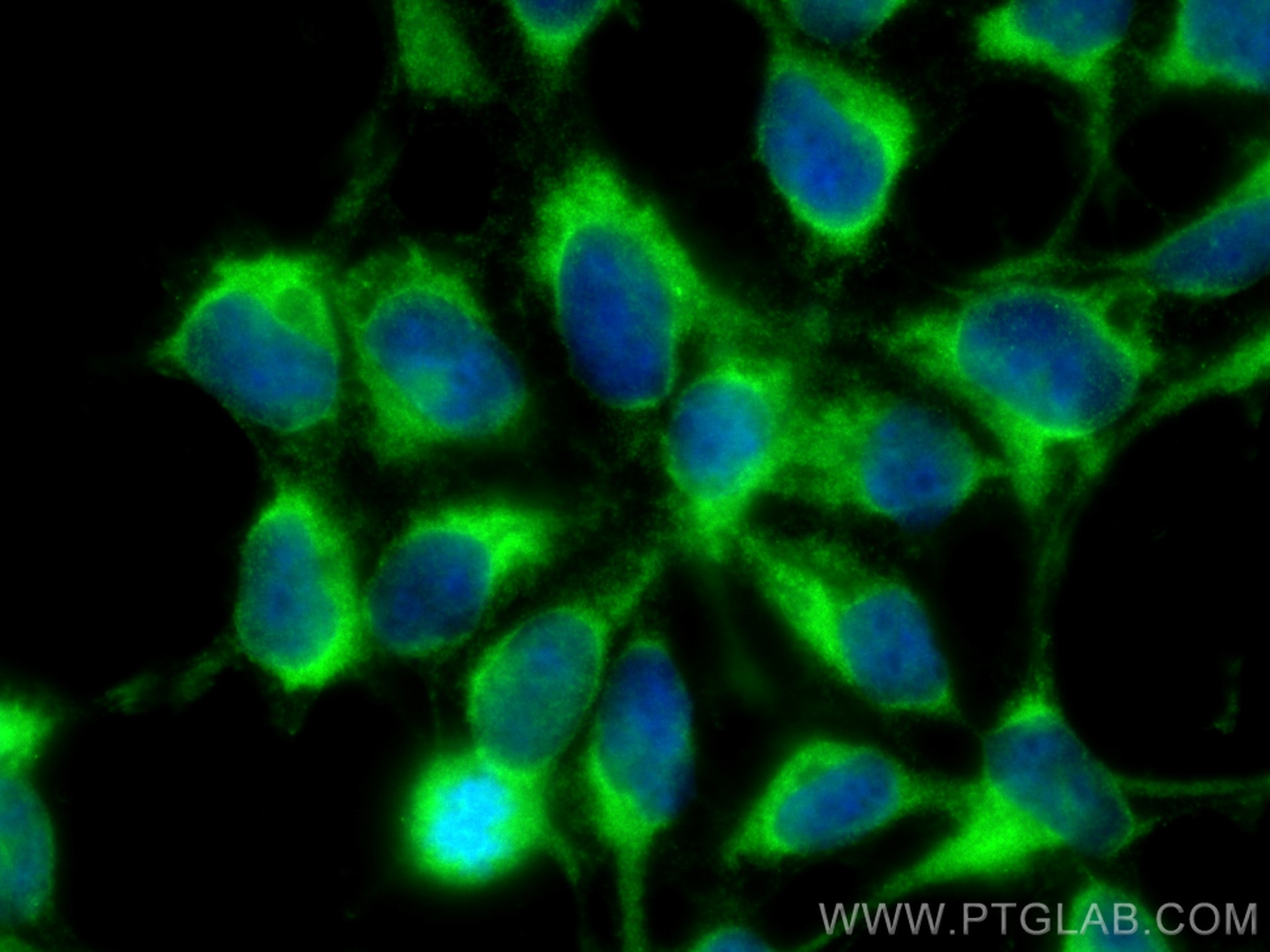 Immunofluorescence (IF) / fluorescent staining of HEK-293 cells using MTHFD1 Monoclonal antibody (67670-1-Ig)