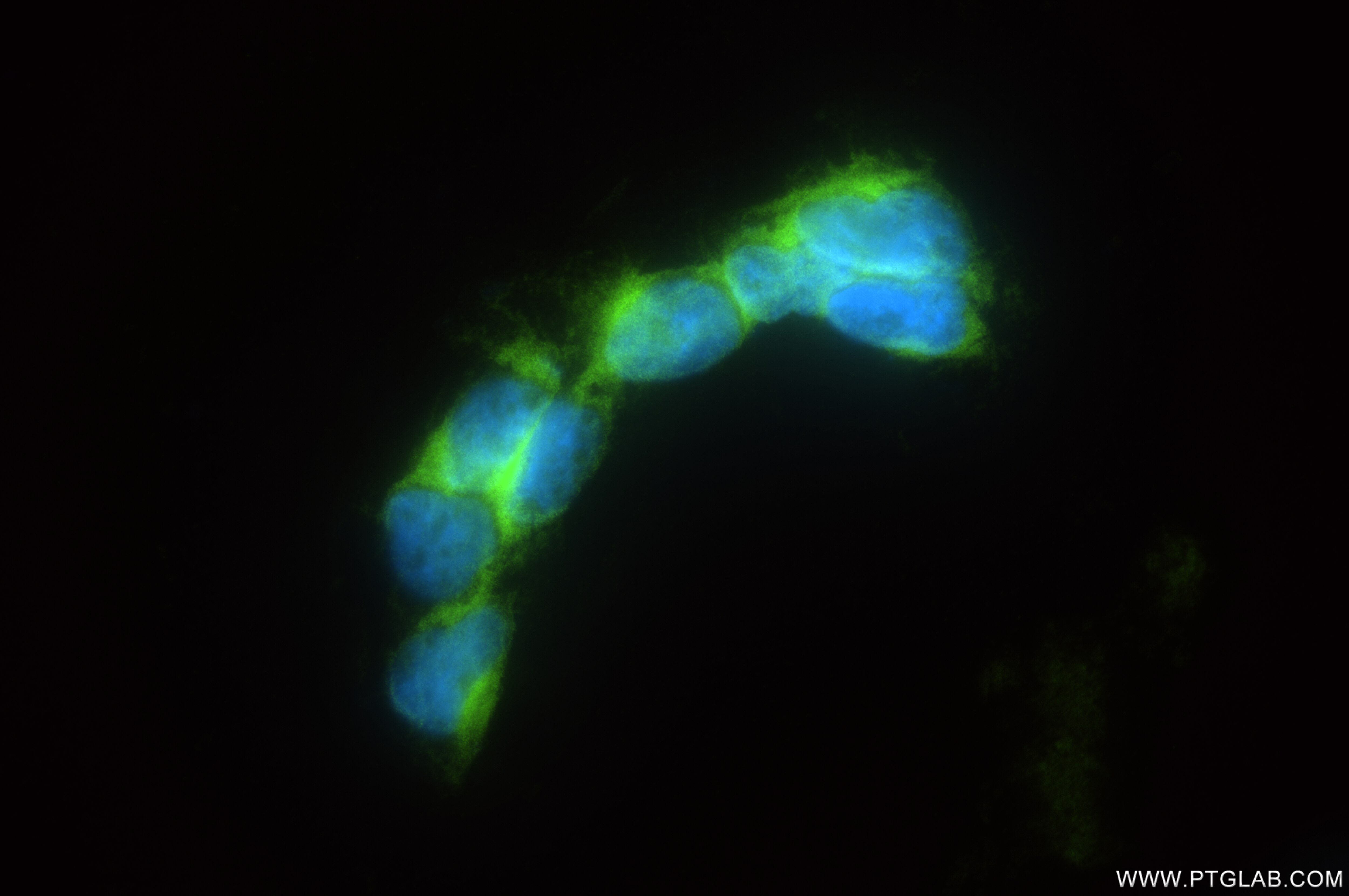 Immunofluorescence (IF) / fluorescent staining of HEK-293 cells using MTHFD1 Recombinant antibody (84884-5-RR)