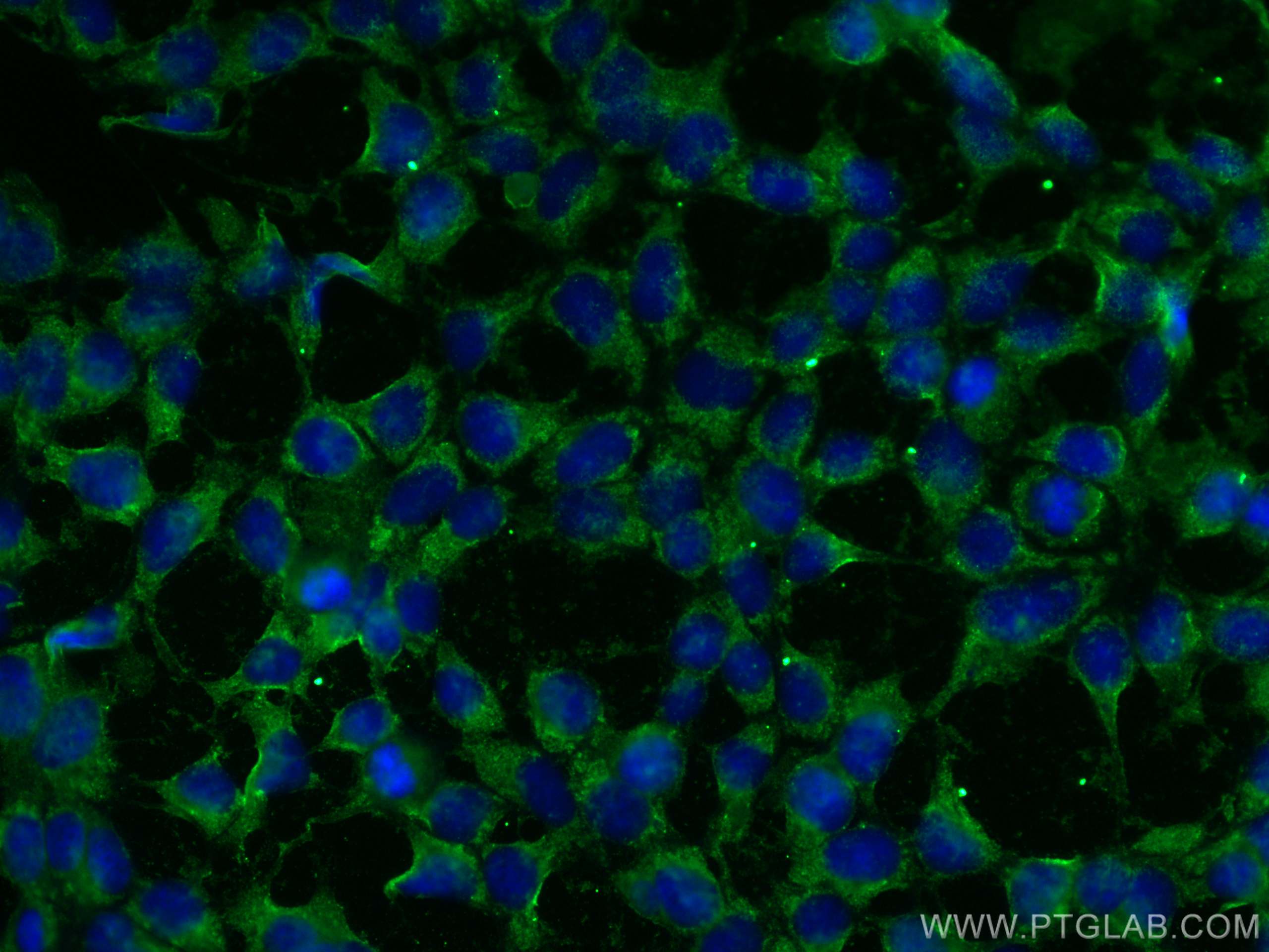 Immunofluorescence (IF) / fluorescent staining of HEK-293 cells using CoraLite® Plus 488-conjugated MTHFD1 Monoclonal an (CL488-67670)