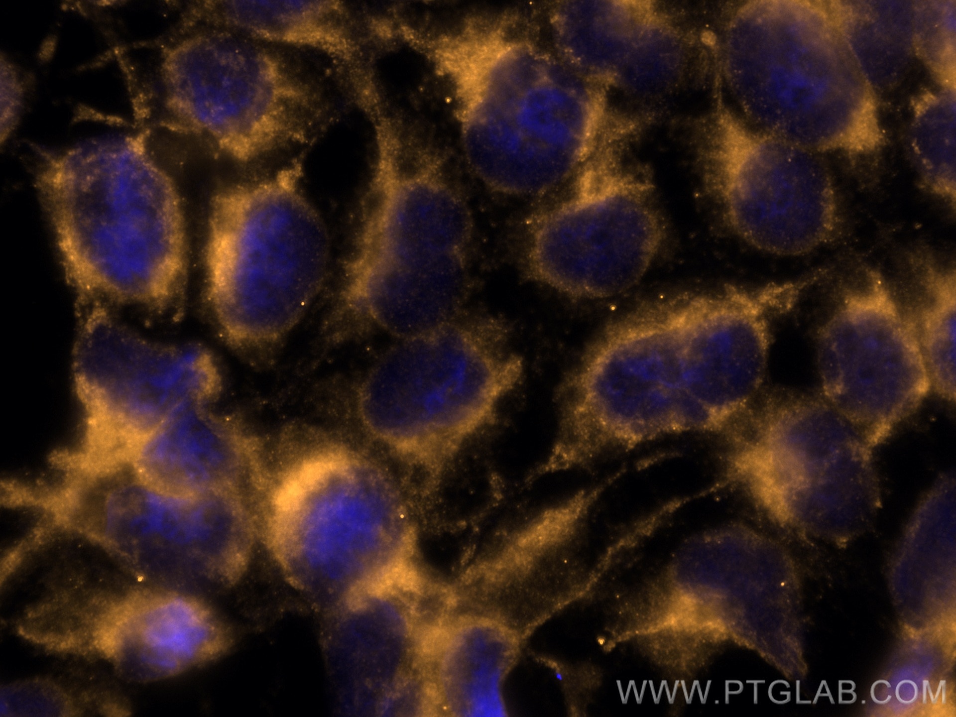 IF Staining of HEK-293 using CL555-67670