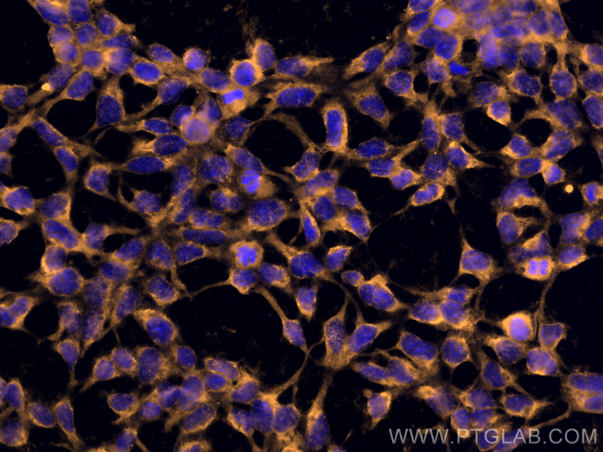 Immunofluorescence (IF) / fluorescent staining of HEK-293 cells using CoraLite®555-conjugated MTHFD1 Monoclonal antibody (CL555-67670)