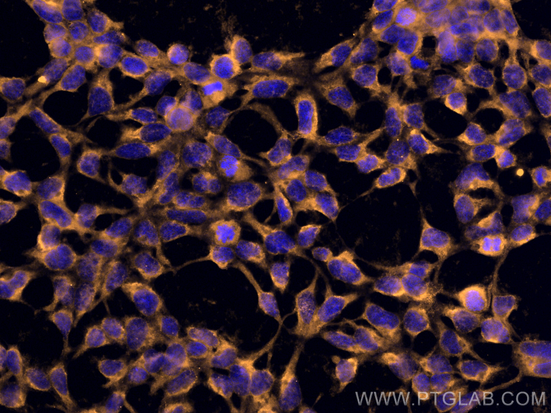 IF Staining of HEK-293 using CL555-67670