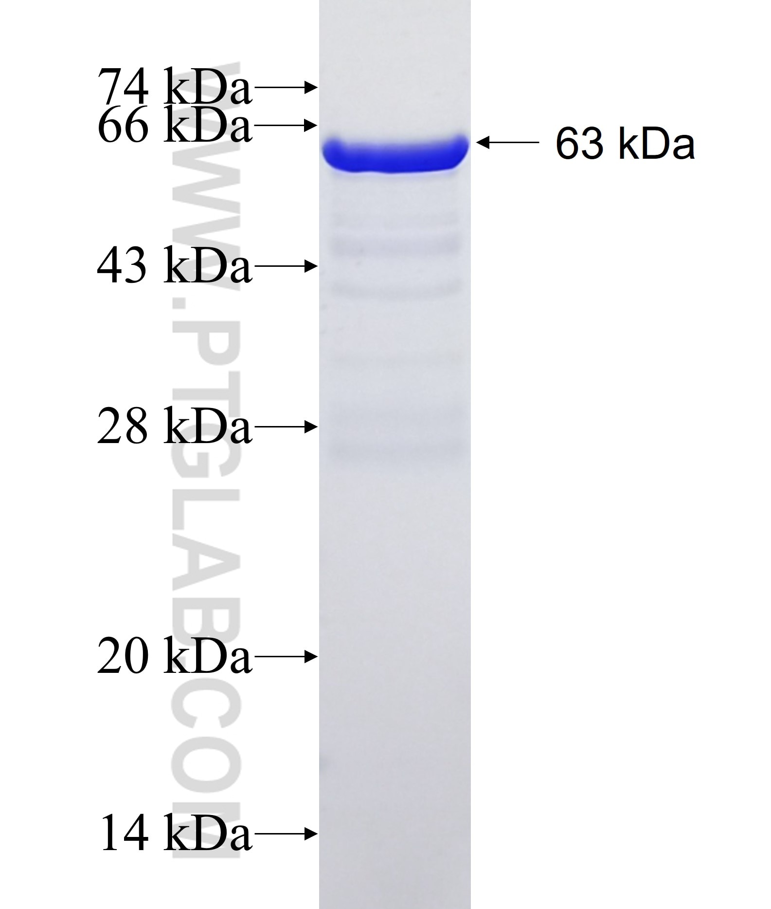 MTHFD1 fusion protein Ag1225 SDS-PAGE