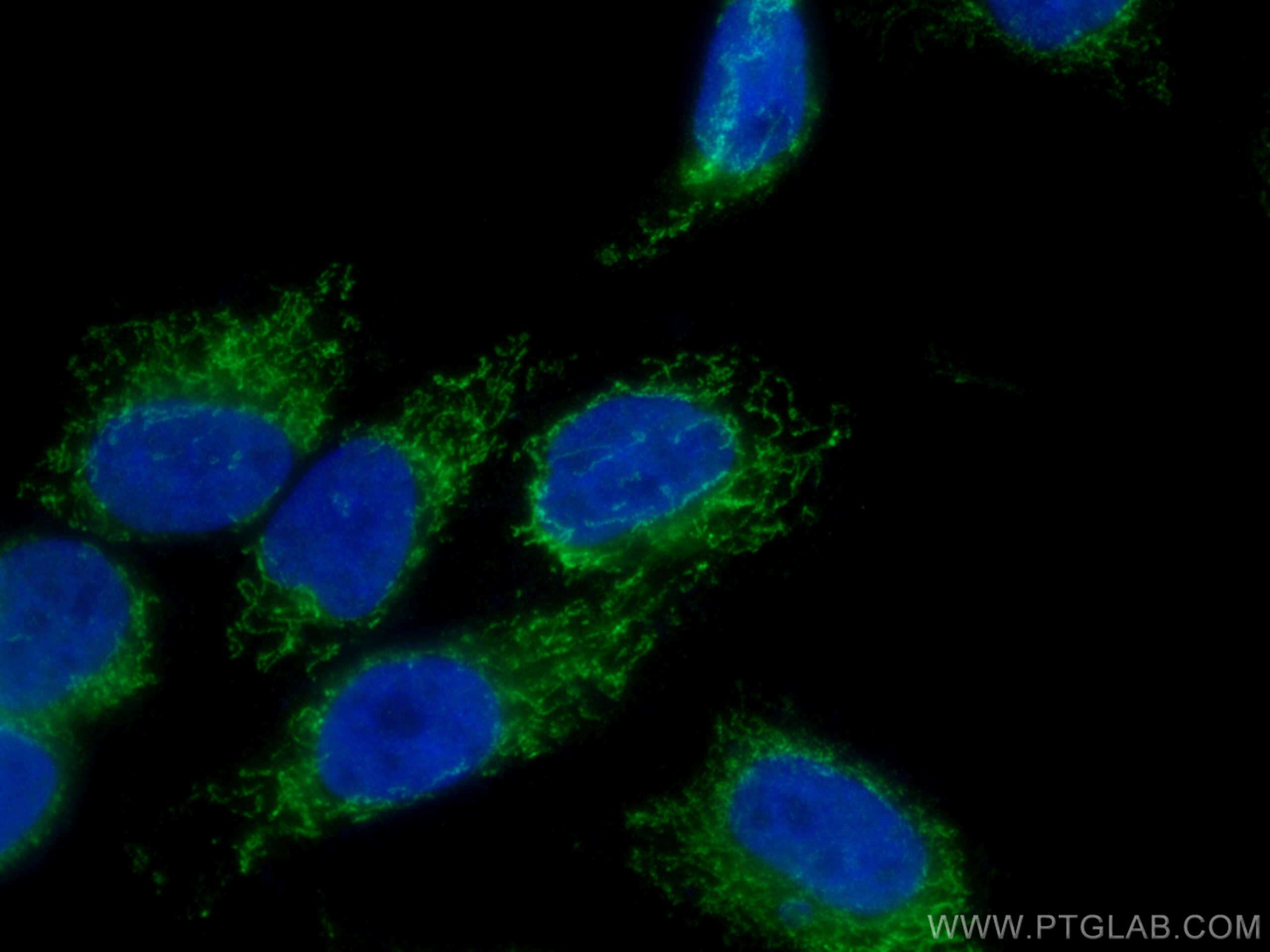 Immunofluorescence (IF) / fluorescent staining of HepG2 cells using MTHFD1L Polyclonal antibody (16113-1-AP)