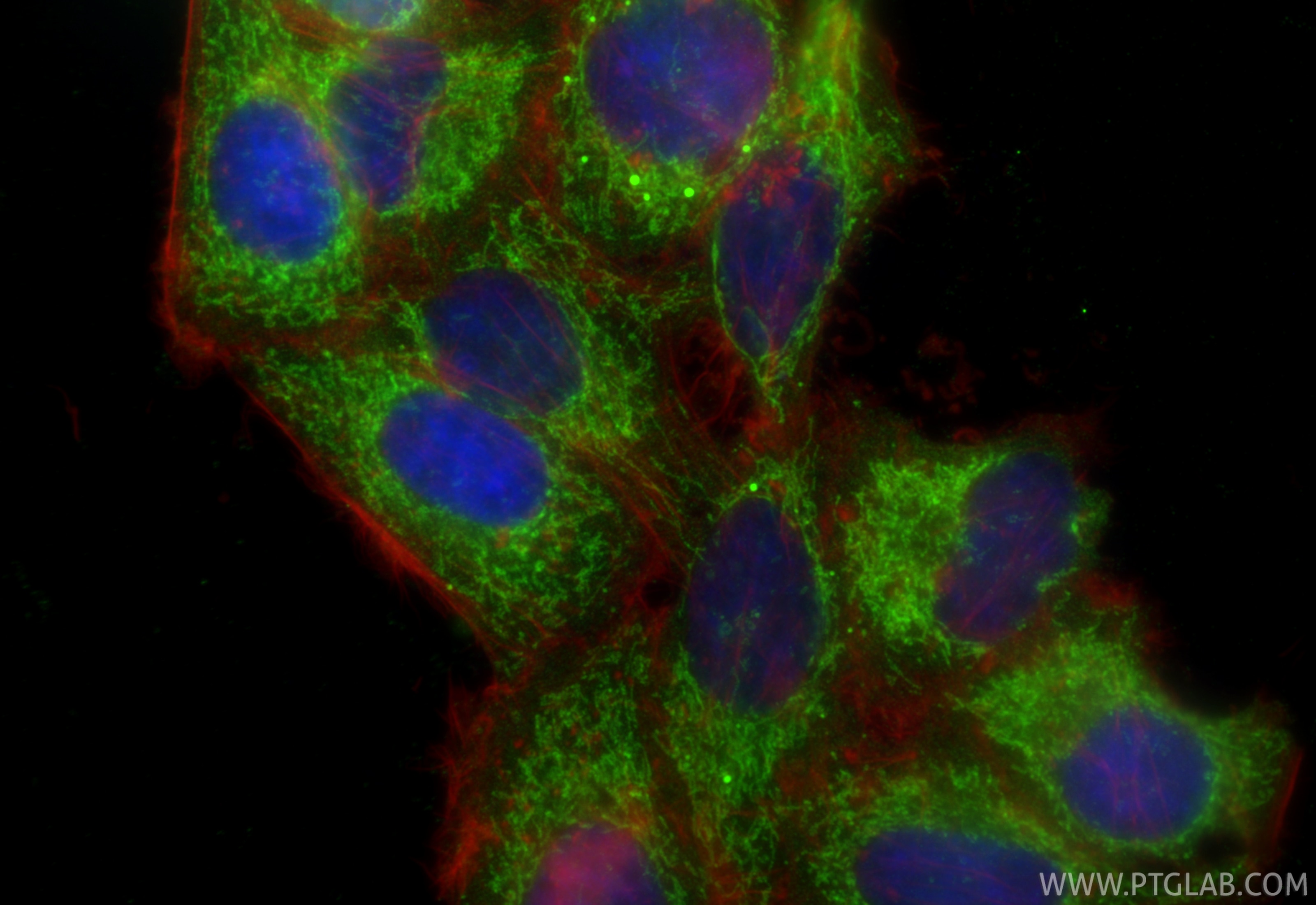 Immunofluorescence (IF) / fluorescent staining of HepG2 cells using MTHFD1L Polyclonal antibody (16113-1-AP)