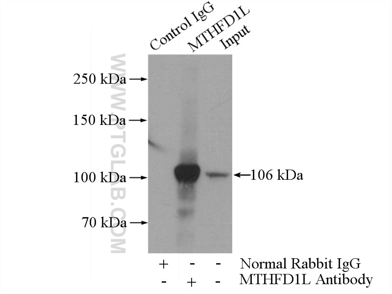 Immunoprecipitation (IP) experiment of HeLa cells using MTHFD1L Polyclonal antibody (16113-1-AP)