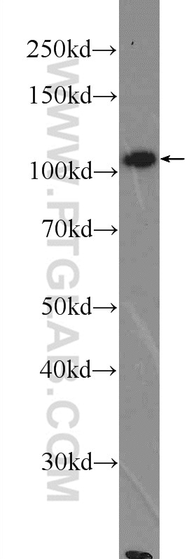 Western Blot (WB) analysis of COLO 320 cells using MTHFD1L Polyclonal antibody (16113-1-AP)