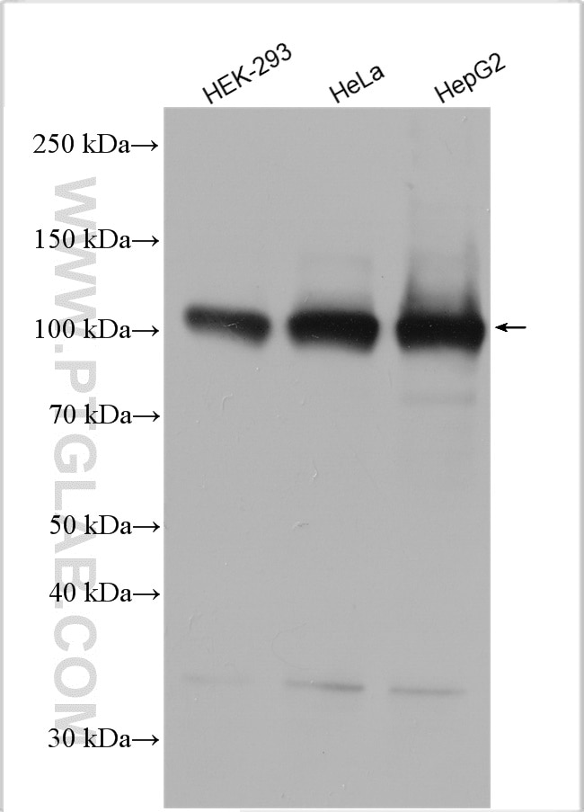 Western Blot (WB) analysis of various lysates using MTHFD1L Polyclonal antibody (16113-1-AP)