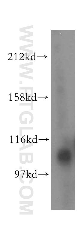 Western Blot (WB) analysis of mouse ovary tissue using MTHFD1L Polyclonal antibody (16113-1-AP)