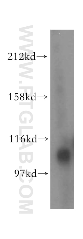 Western Blot (WB) analysis of mouse ovary tissue using MTHFD1L Polyclonal antibody (16113-1-AP)