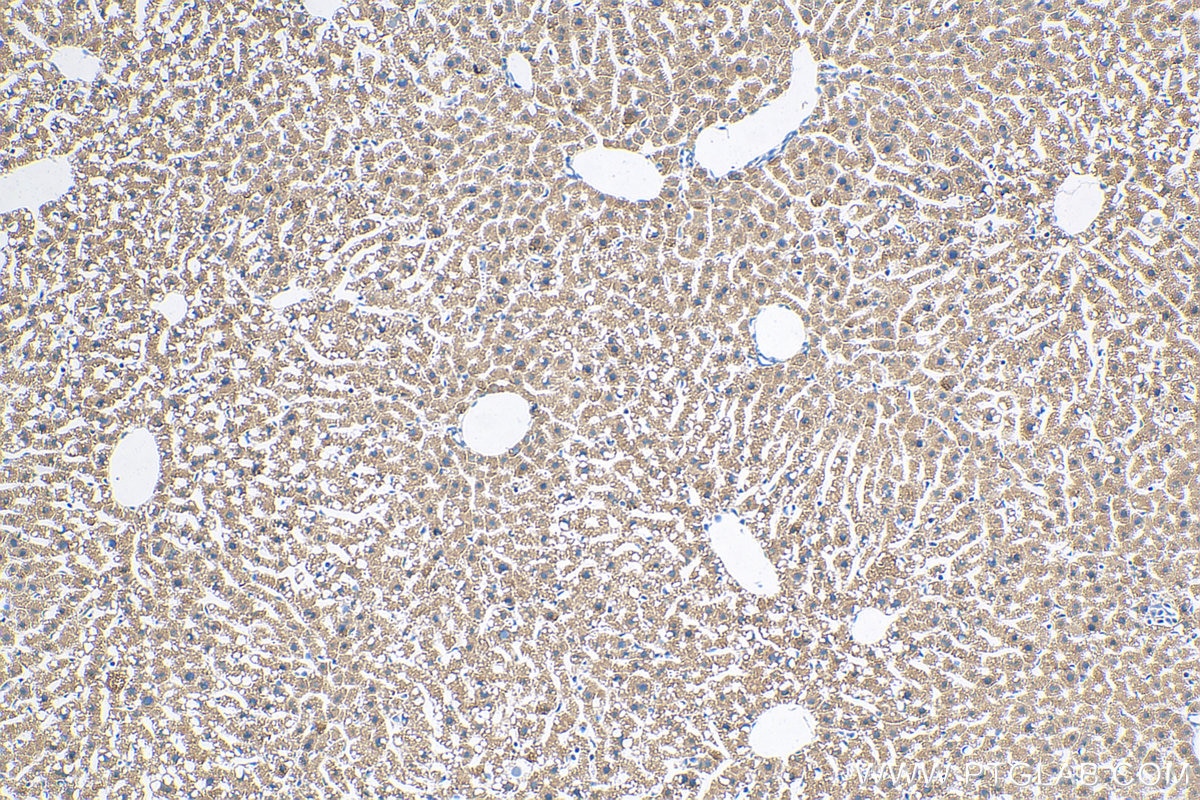 Immunohistochemistry (IHC) staining of mouse liver tissue using MTHFD1L Monoclonal antibody (68321-1-Ig)