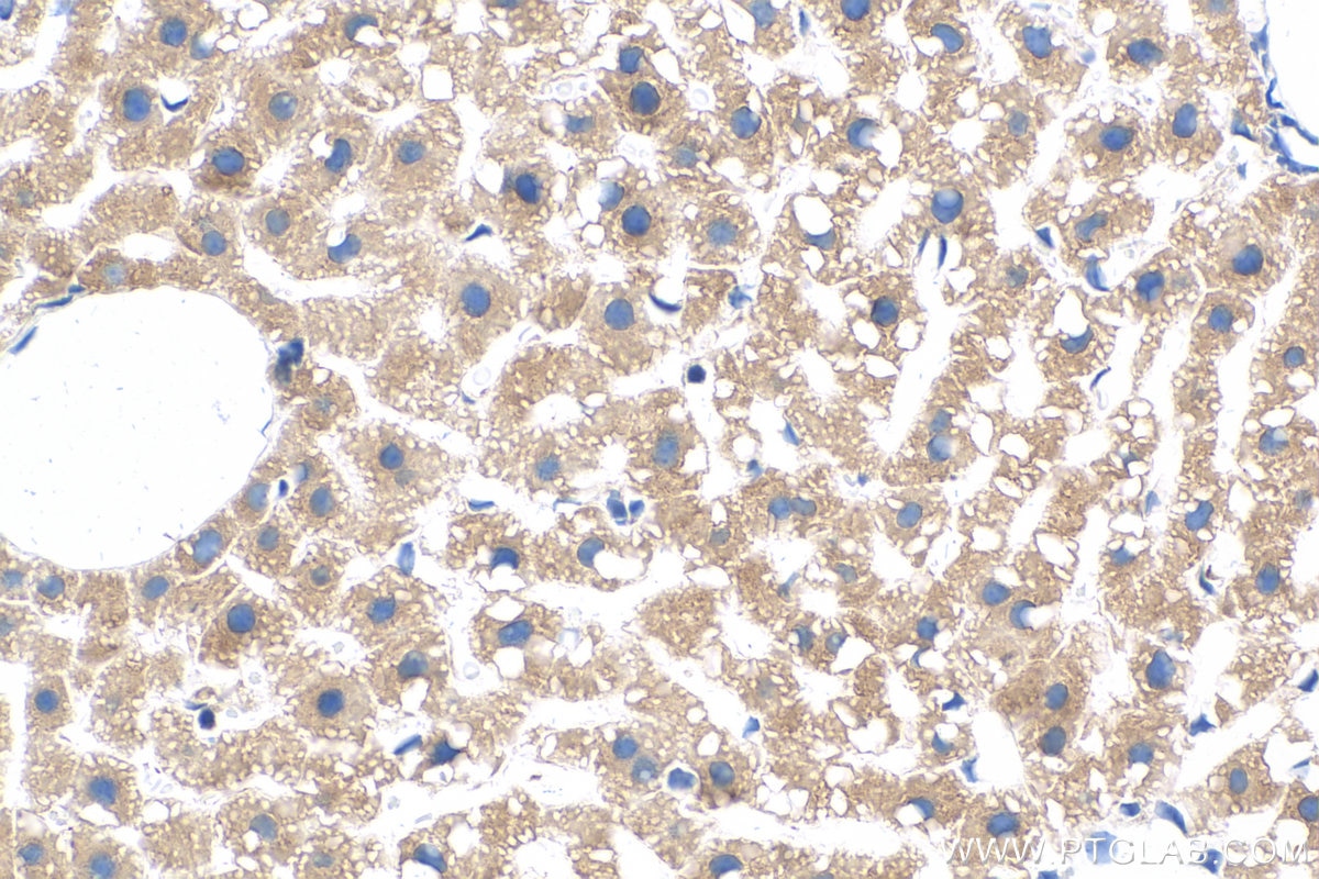 Immunohistochemistry (IHC) staining of mouse liver tissue using MTHFD1L Monoclonal antibody (68321-1-Ig)
