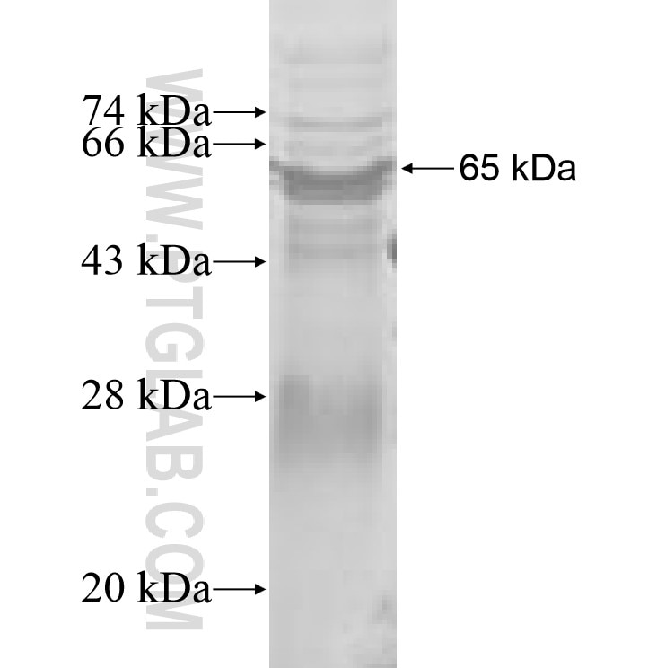 MTHFD1L fusion protein Ag9036 SDS-PAGE