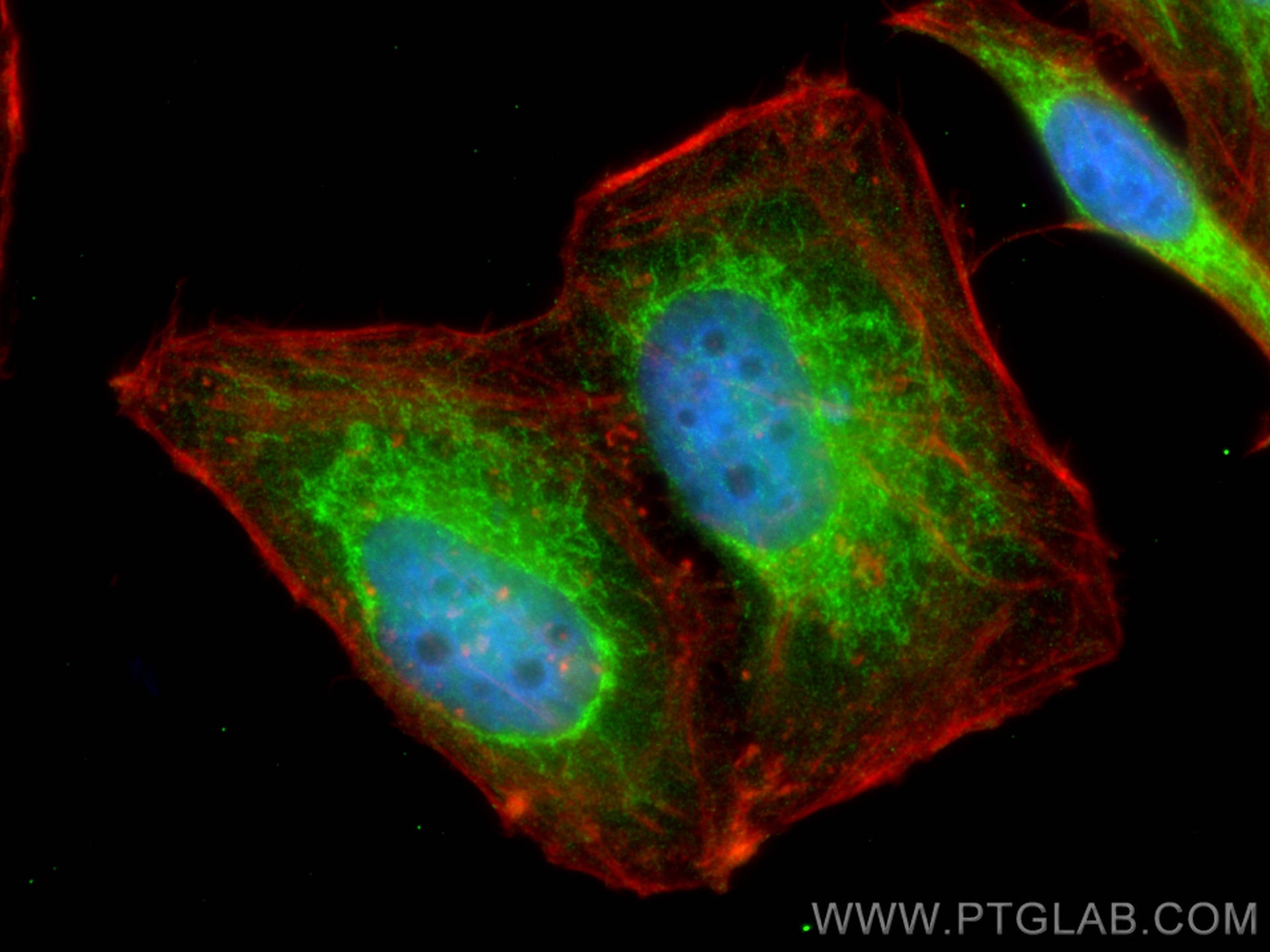 Immunofluorescence (IF) / fluorescent staining of HepG2 cells using MTHFD2 Polyclonal antibody (12270-1-AP)