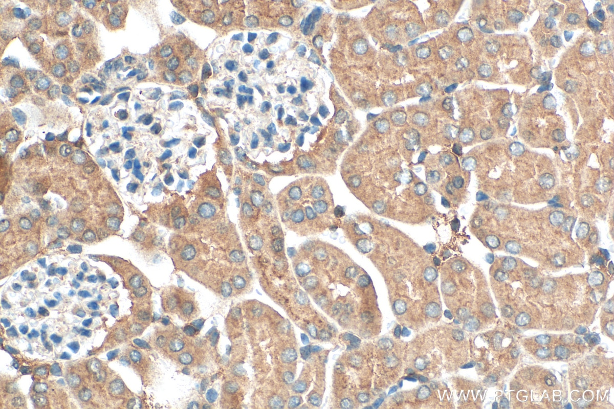 Immunohistochemistry (IHC) staining of mouse kidney tissue using MTHFD2 Monoclonal antibody (68524-1-Ig)