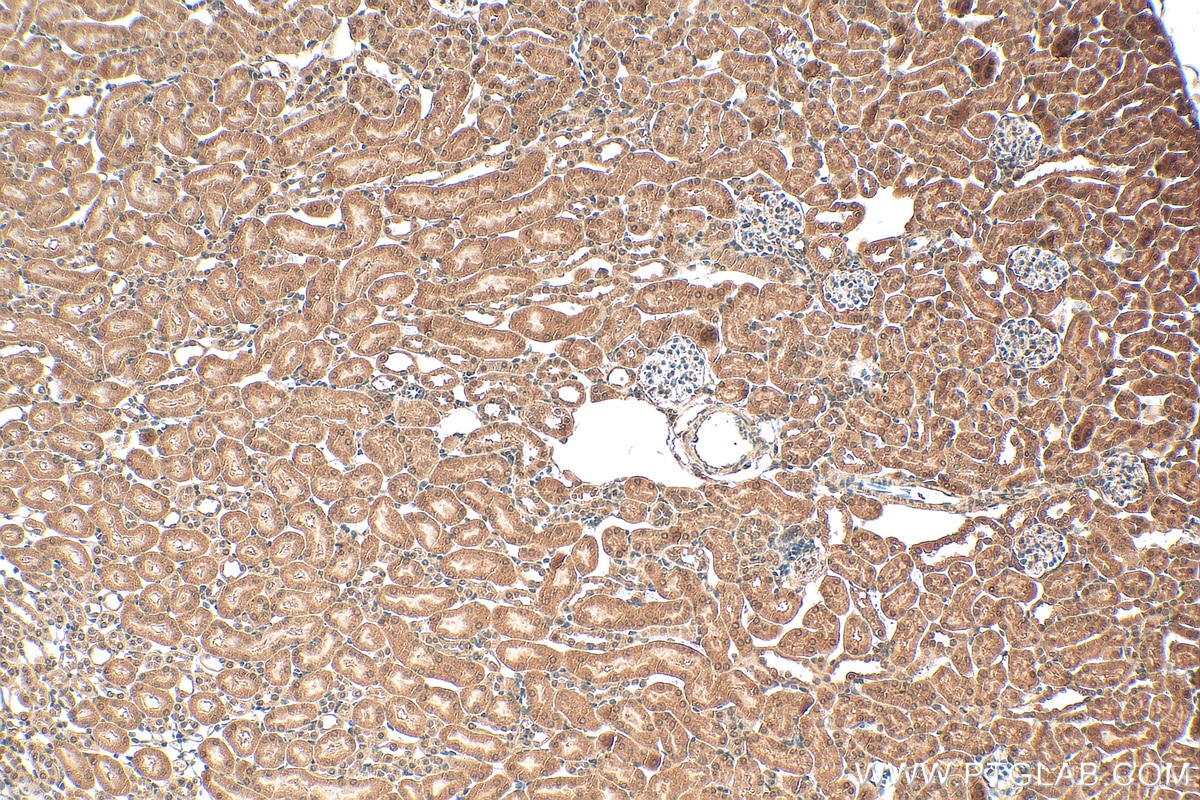 Immunohistochemistry (IHC) staining of mouse kidney tissue using MTHFD2 Monoclonal antibody (68524-1-Ig)