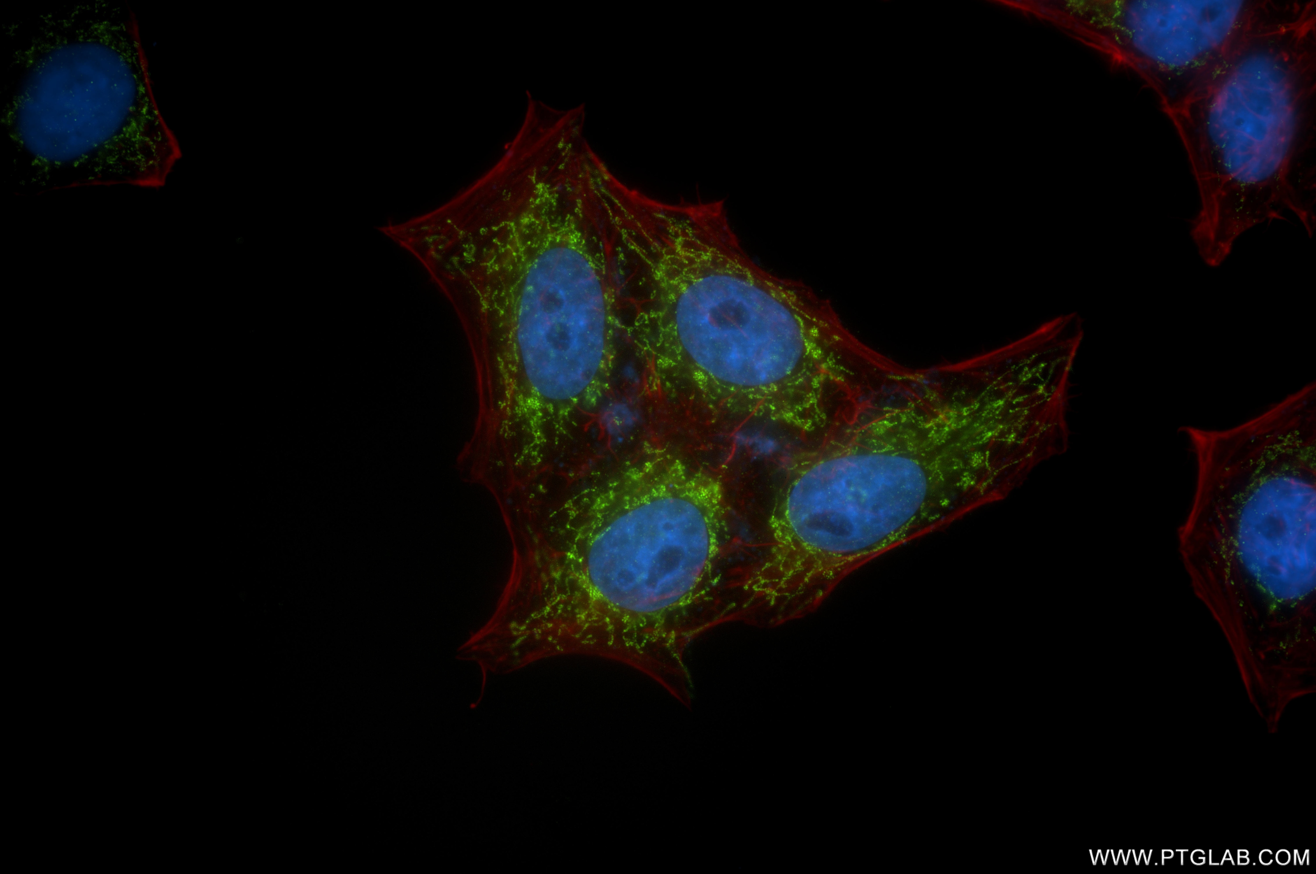 IF Staining of HepG2 using 86608-3-RR Immunofluorescence (IF) / fluorescent staining of HepG2 cells using MTHFD2 Recombinant monoclonal antibody (86608-3-RR)