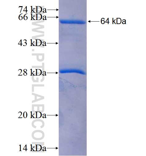 MTHFD2 fusion protein Ag2911 SDS-PAGE