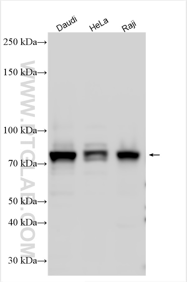 Western Blot (WB) analysis of various lysates using MTHFR Polyclonal antibody (26591-1-AP)