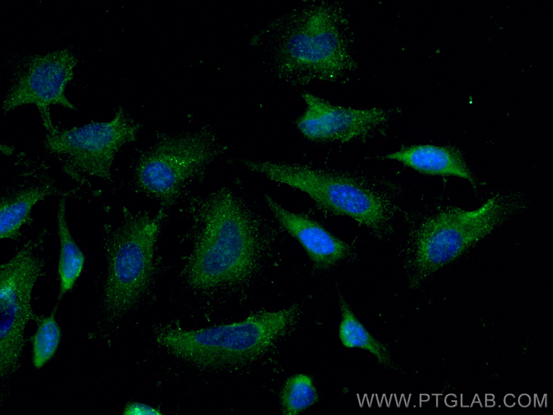 Immunofluorescence (IF) / fluorescent staining of HeLa cells using MTHFR Monoclonal antibody (66612-1-Ig)