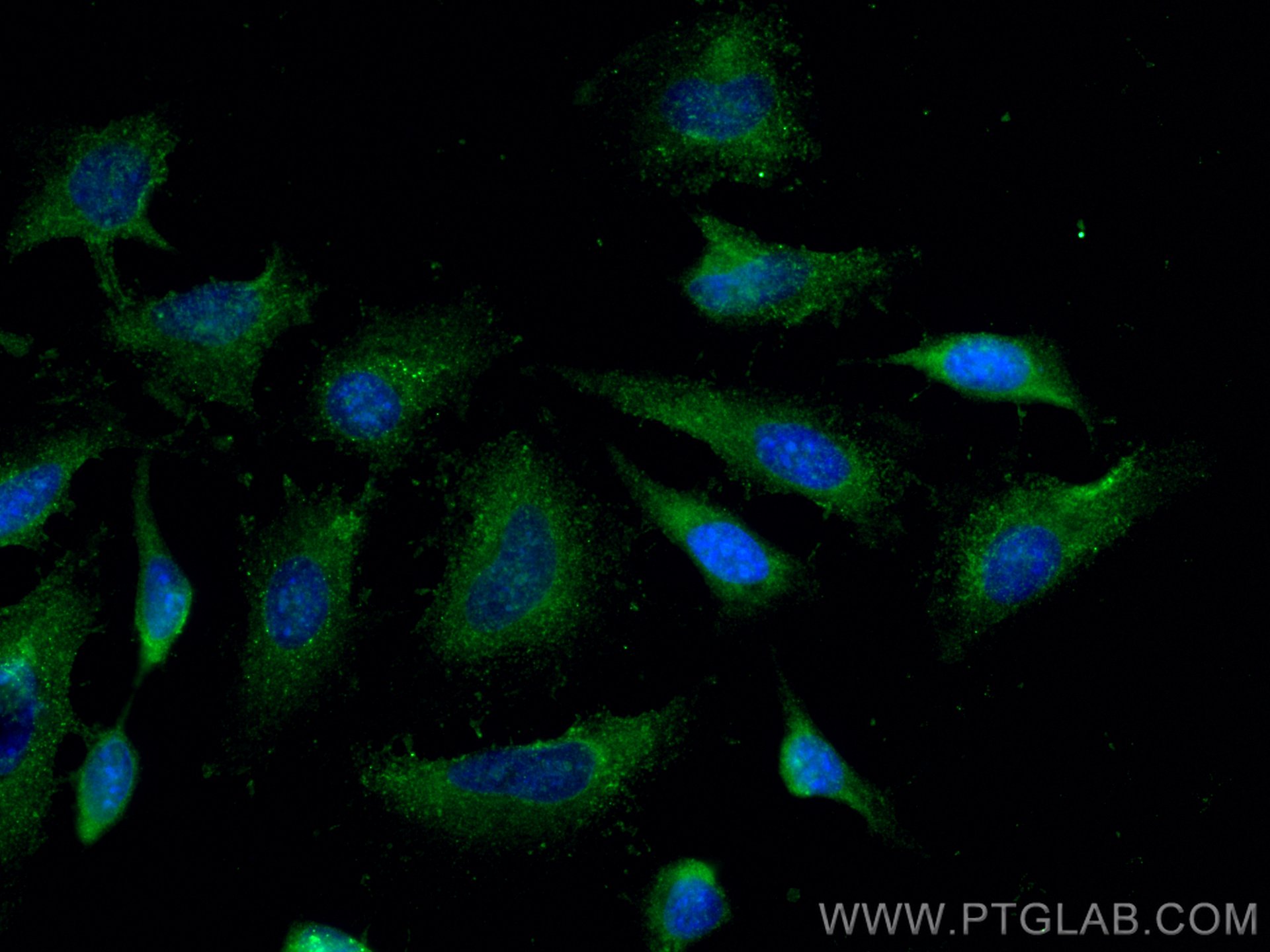 IF Staining of HeLa using 66612-1-Ig