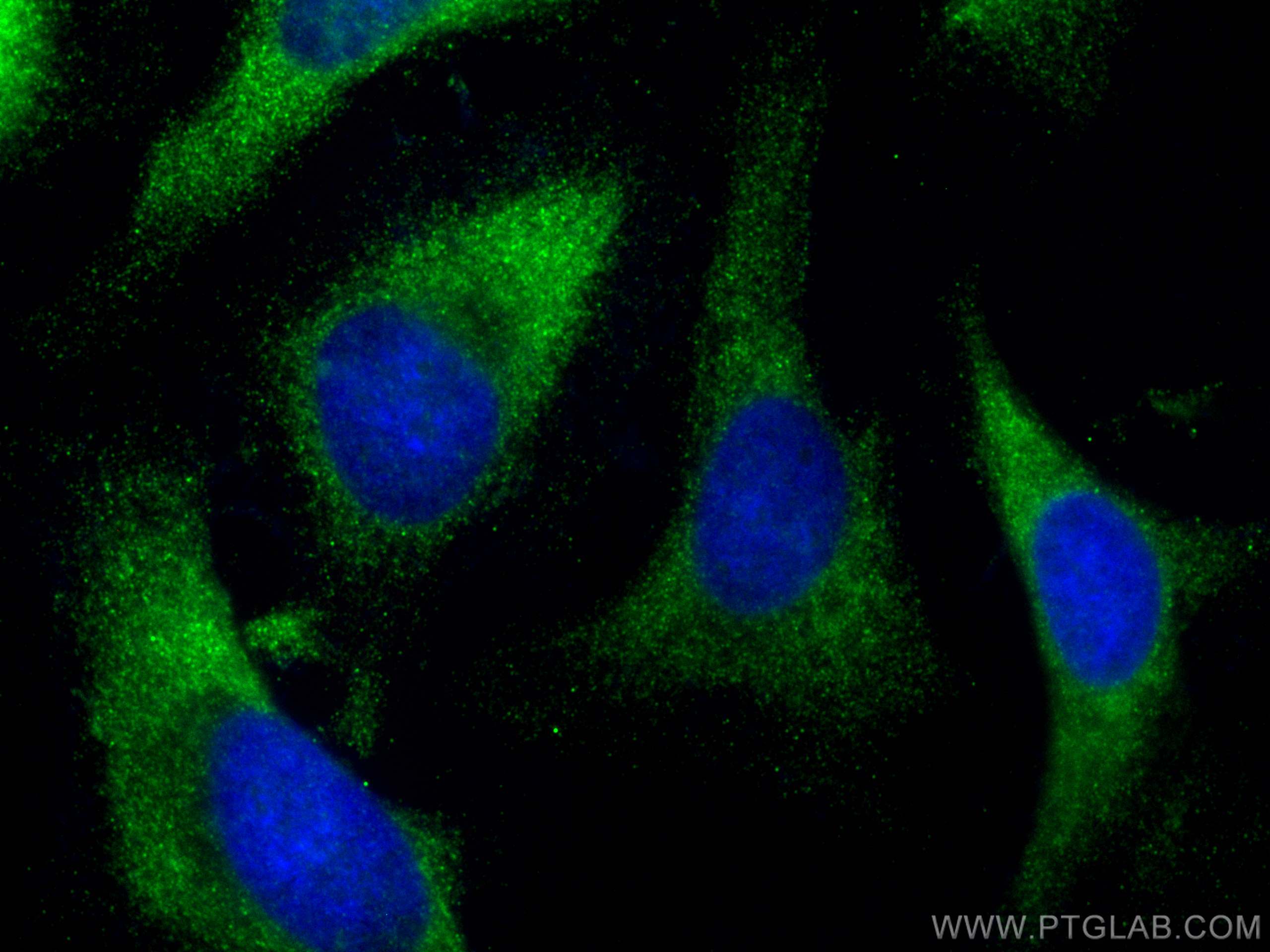 Immunofluorescence (IF) / fluorescent staining of HeLa cells using MTHFR Monoclonal antibody (66612-1-Ig)