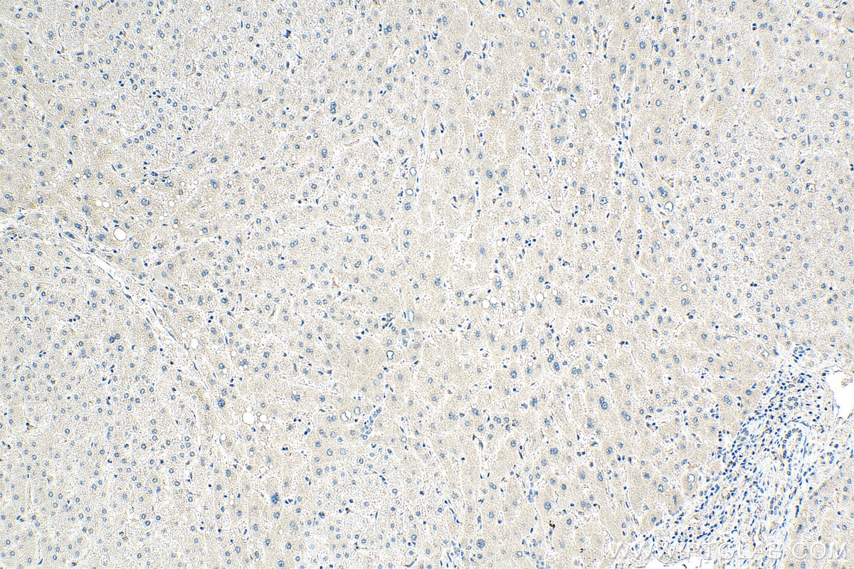Immunohistochemistry (IHC) staining of human liver tissue using MTHFR Monoclonal antibody (66612-1-Ig)