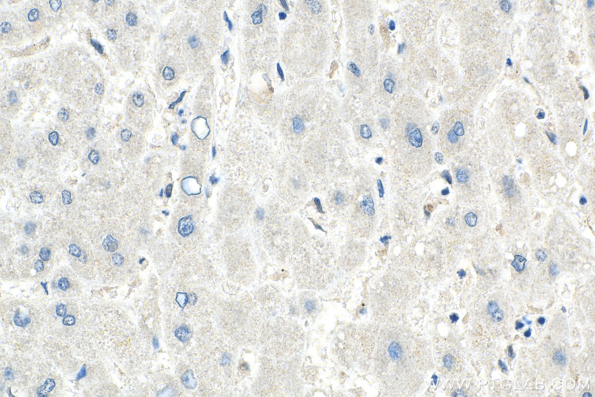 Immunohistochemistry (IHC) staining of human liver tissue using MTHFR Monoclonal antibody (66612-1-Ig)