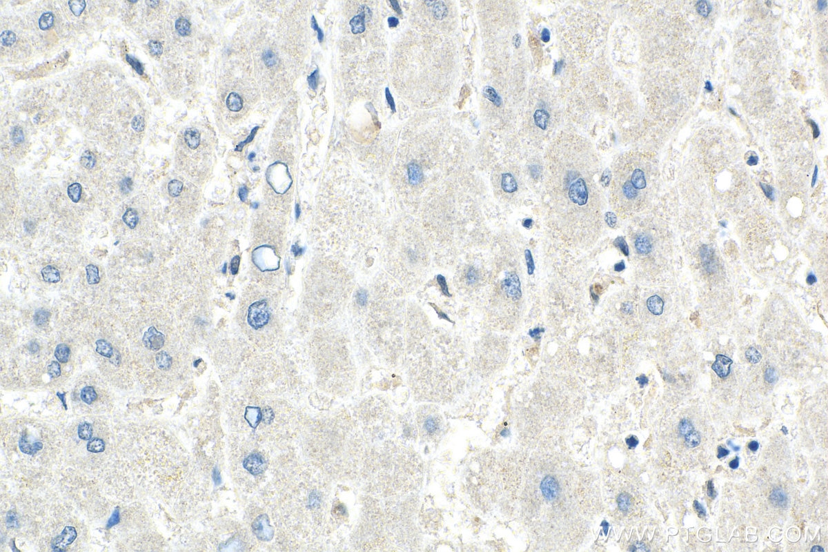 IHC staining of human liver using 66612-1-Ig