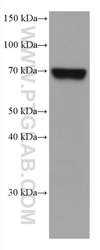 Western Blot (WB) analysis of LNCaP cells using MTHFR Monoclonal antibody (66612-1-Ig)