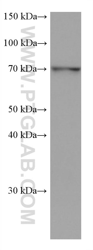 Western Blot (WB) analysis of HeLa cells using MTHFR Monoclonal antibody (66612-1-Ig)