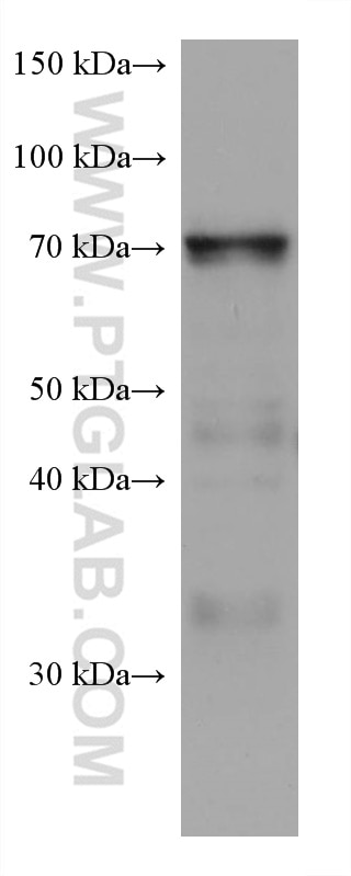 Western Blot (WB) analysis of HepG2 cells using MTHFR Monoclonal antibody (66612-1-Ig)