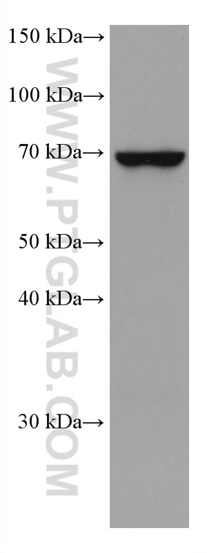 Western Blot (WB) analysis of Jurkat cells using MTHFR Monoclonal antibody (66612-1-Ig)