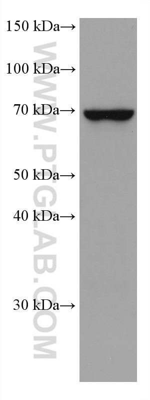 Western Blot (WB) analysis of Jurkat cells using MTHFR Monoclonal antibody (66612-1-Ig)