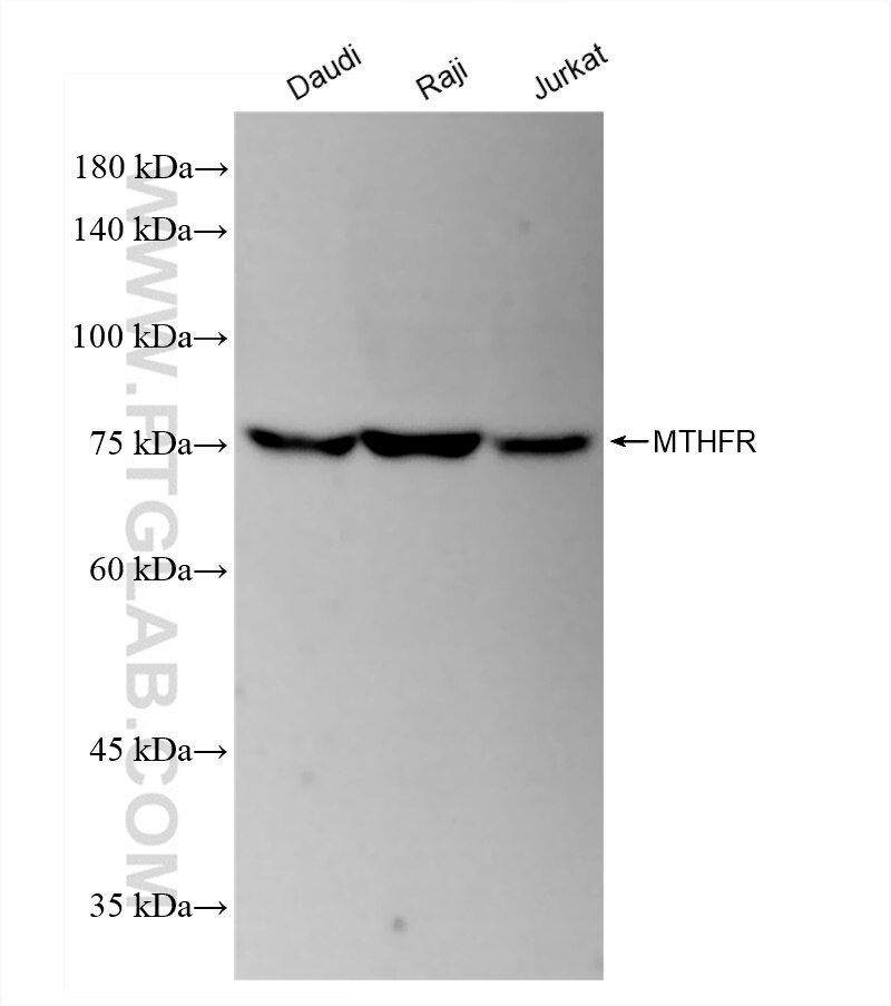 Western Blot (WB) analysis of various lysates using MTHFR Recombinant antibody (83372-7-RR)