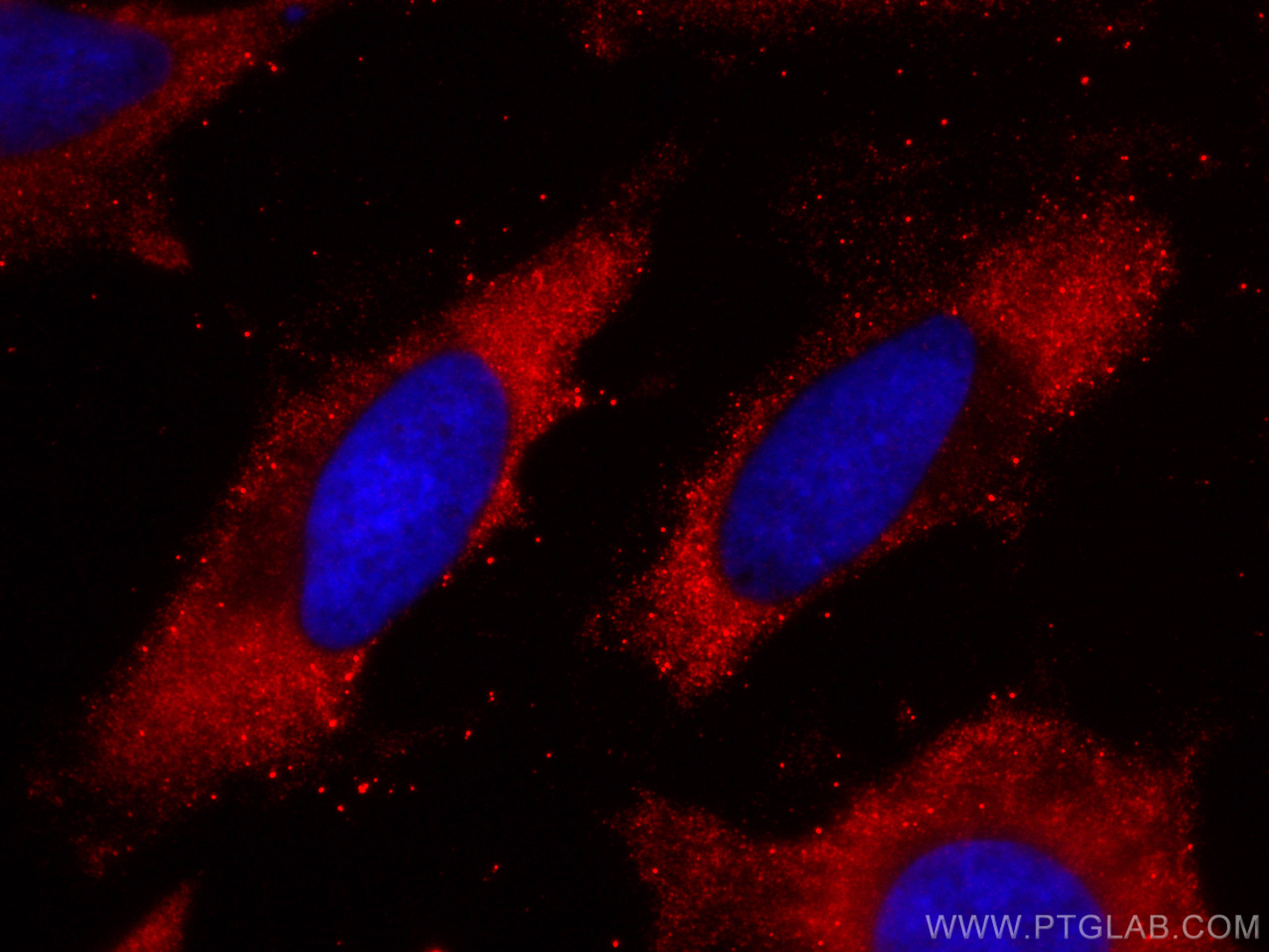 Immunofluorescence (IF) / fluorescent staining of HeLa cells using CoraLite®594-conjugated MTHFR Monoclonal antibody (CL594-66612)