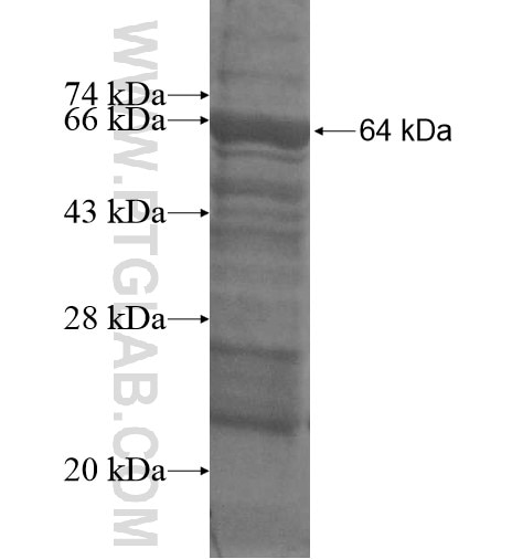 MTHFR fusion protein Ag14970 SDS-PAGE