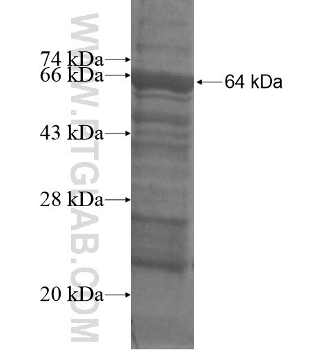 MTHFR fusion protein Ag14970 SDS-PAGE