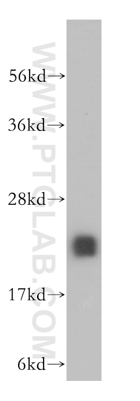 Western Blot (WB) analysis of human liver tissue using MTHFS Polyclonal antibody (13114-1-AP)
