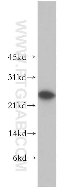 Western Blot (WB) analysis of Jurkat cells using MTHFS Polyclonal antibody (13114-1-AP)