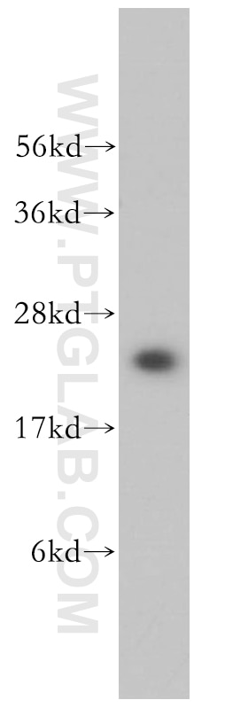 Western Blot (WB) analysis of human stomach tissue using MTHFS Polyclonal antibody (13114-1-AP)