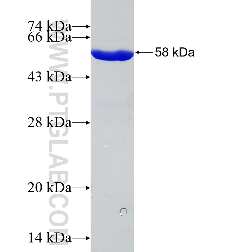 MTHFS fusion protein Ag3781 SDS-PAGE