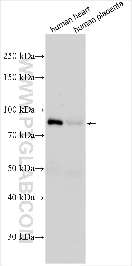 Western Blot (WB) analysis of various lysates using MTIF2 Polyclonal antibody (55325-1-AP)
