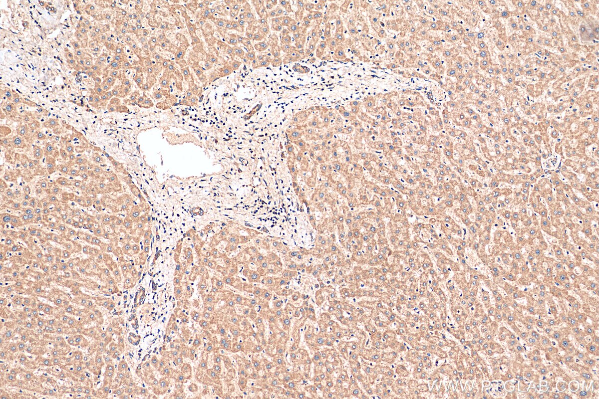 Immunohistochemistry (IHC) staining of human liver tissue using MTIF3 Polyclonal antibody (14219-1-AP)