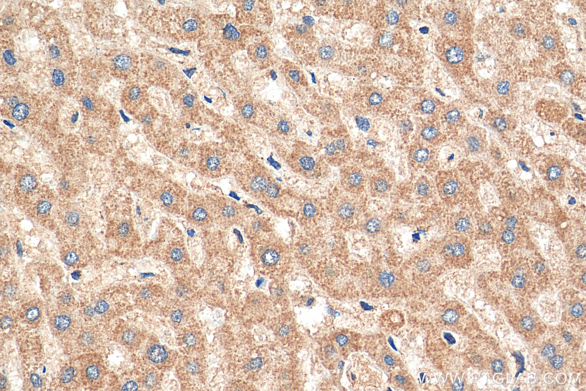 Immunohistochemistry (IHC) staining of human liver tissue using MTIF3 Polyclonal antibody (14219-1-AP)