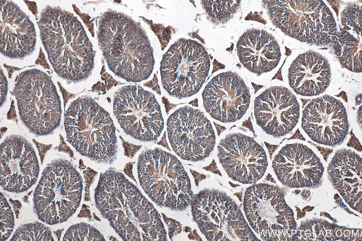 Immunohistochemistry (IHC) staining of mouse testis tissue using MTIF3 Polyclonal antibody (14219-1-AP)
